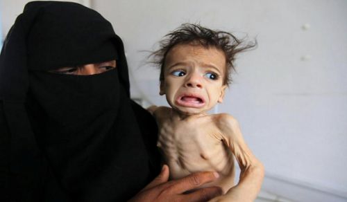 Famine is Almost Killing the People of Yemen and the War of the Conflicting Parties Enters its Third Year