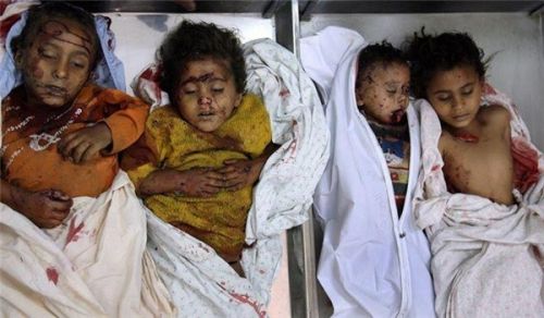 یمن کے بچوں کے لئے کون ہے؟