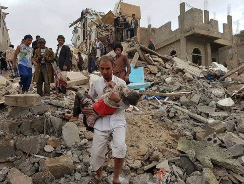 Hilafetin Yıkılışının Yıldönümünde Yemen ve Tüm İslam Ülkeleri Trajediyle Boğuşmaktadır, Hadi Öyleyse Bu Yıldönümü, Hilafeti Kurma Çalışması İçin bir Motivasyon Olsun